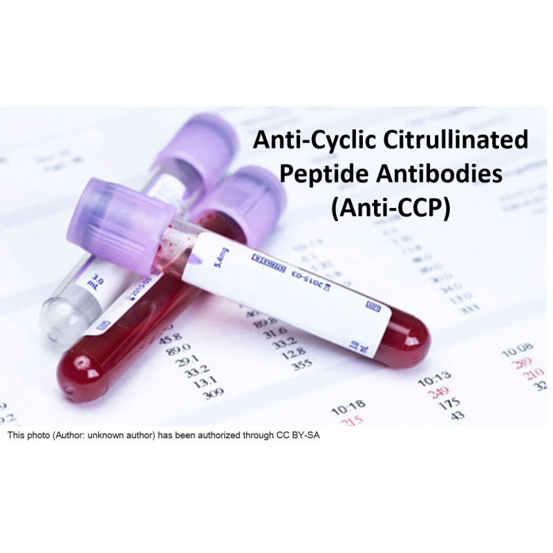 What Is the Anti-Cyclic Citrullinated Peptides (Anti-CCP) Blood Test?